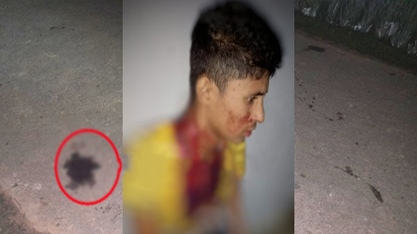 ছুরিকাঘাতে যুবক আহত, আটক ১জন