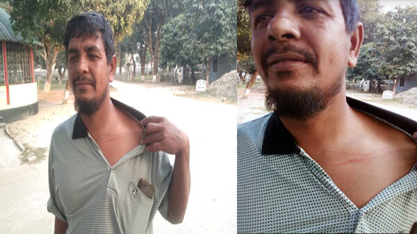 রাণীশংকৈলে শিক্ষক সমিতির ঘর মেরামতে বাধা; ২ শিক্ষক আহত থানায় অভিযোগ