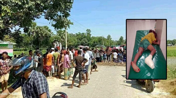 বালু বহনকারী গাড়ির ধাক্কায় পা ভাঙ্গলো ১ম শ্রেনীর ছাত্রীর