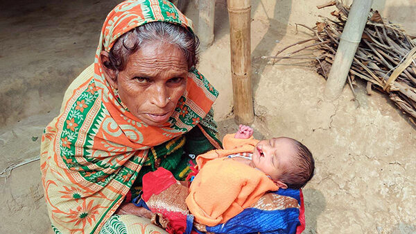 কমলগঞ্জে মলদ্বার বিহীন ও ঠোঁট কাটা নবজাতকের জন্ম!