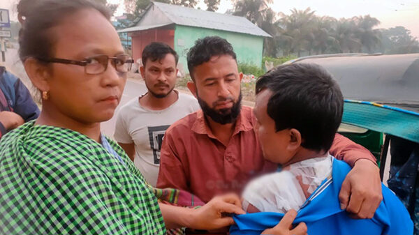 পান গাছ কাটার প্রতিবাদ করায় খাসিয়া যুবক হাসপাতালে